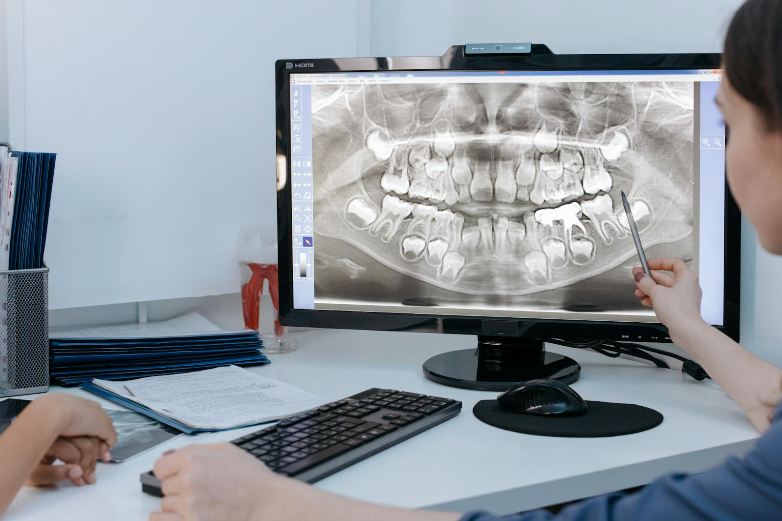 Dentist reviewing a patient's dental x-ray on a computer screen in a clinic.